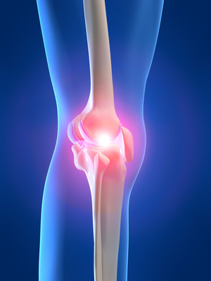 douleurs et inflammation au genou